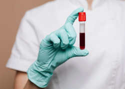 Общий анализ крови(ОАК) - расшифровка показателей
